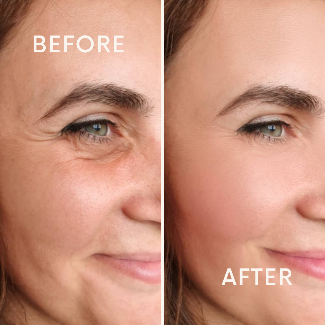 BECUTE FACIAL GLOW SKIN POLISH KIT